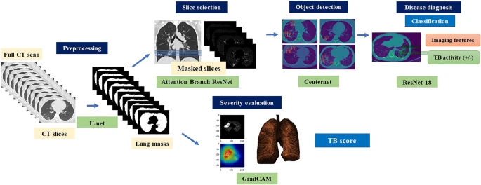 Illustration of the proposed cascading AI pipeline. The AI diagnostic system consists of four subsystems, which provides consistent visual descriptions: (1) screening to distinguish between normal and abnormal CT images, (2) object detection and localization of pulmonary infectious lesions, (3) diagnostic assessment of radiological features (6 types) and TB activity, and (4) severity assessment.