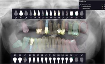 AI Tool to Perform Dental Diagnostics in the Near Future