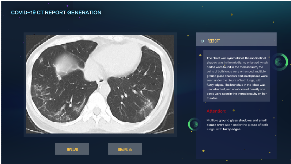 AI-Generated Medical Reports to Offer Accurate, Timely Diagnosis of COVID-19