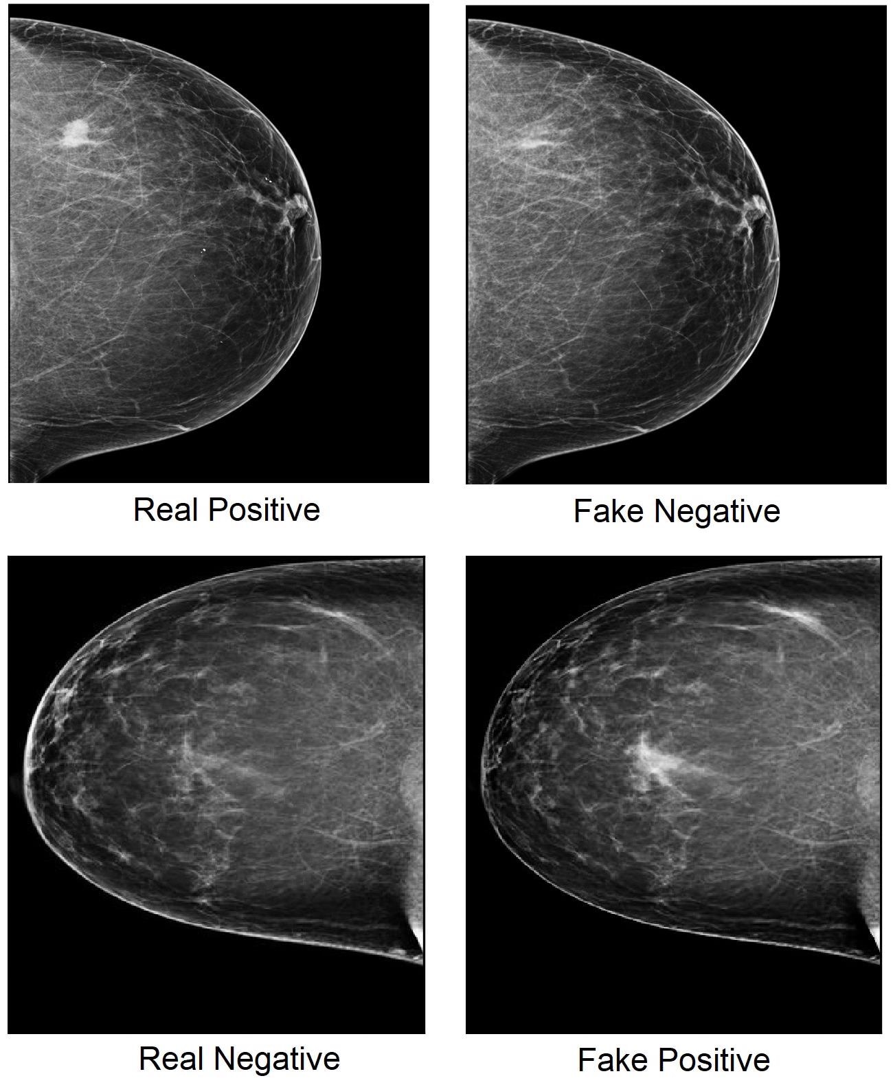 Image-Tampering Attacks can Deceive AI-Cancer-Spotting Models and Human Experts.