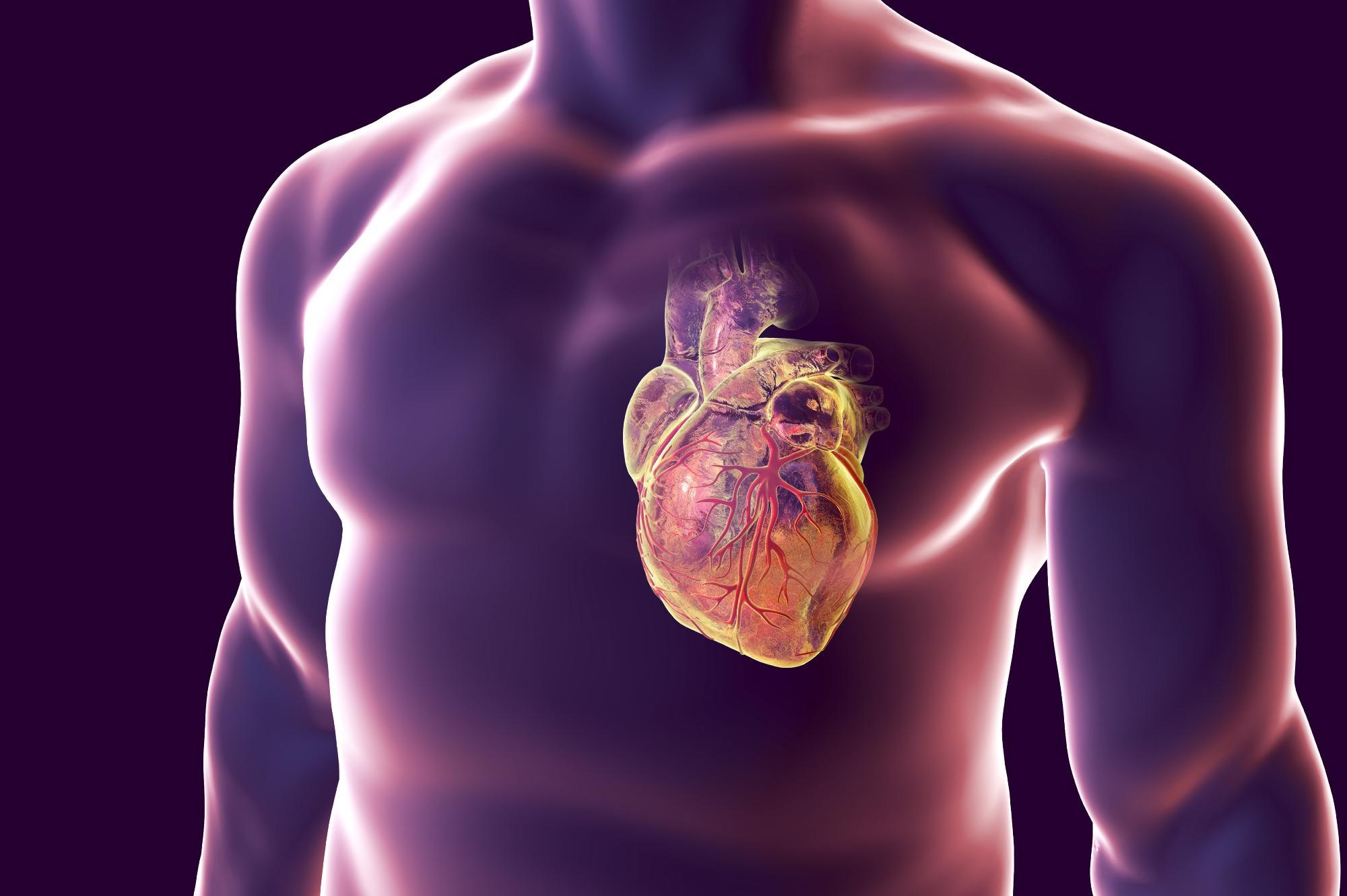Artificial Intelligence to Assist in Personalizing Treatment of Myocarditis.