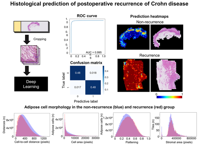 Scientists Develop AI Model That Predicts the Recurrence of Crohn Disease.