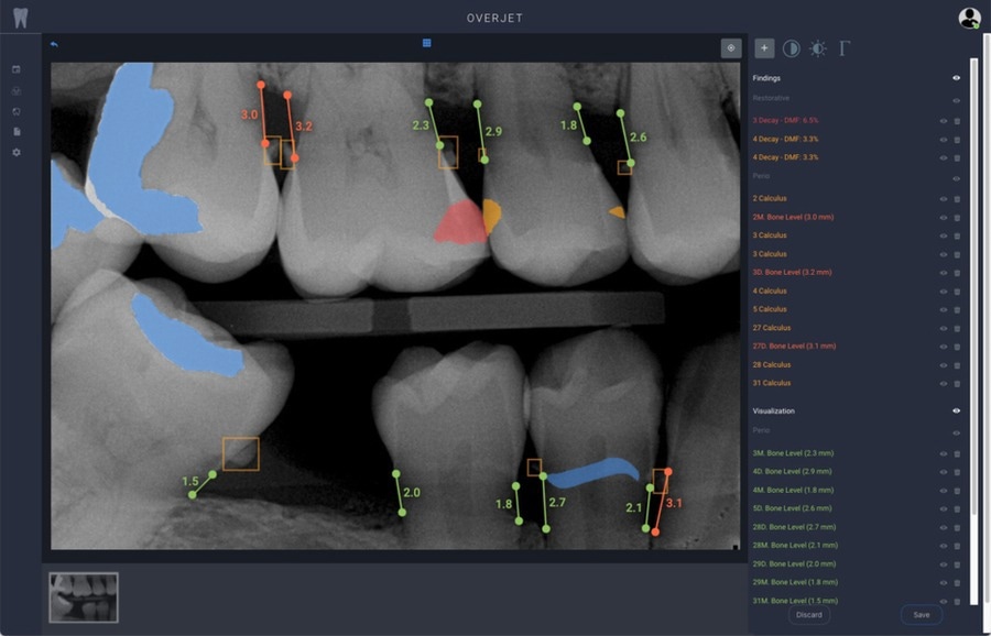 AI: Eliminate the subjectivity of the interpretations of dental x-rays.