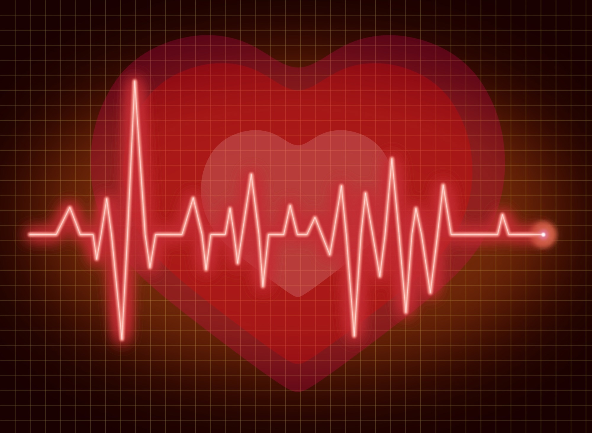 AI Algorithm Derived From Heartbeats Can Foretell Diabetes and Pre-Diabetes