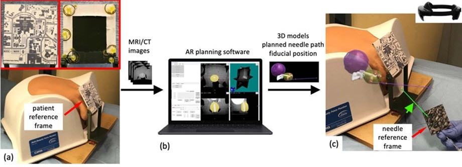 New Approach Based on Augmented Reality for Prostate Cancer Diagnosis