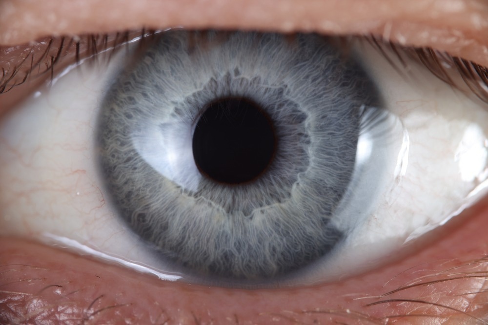 New AI System to Identify the Genetic Cause of IRDs From Retinal Scans