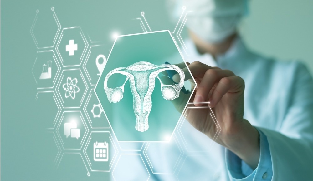 Precise AI Model Predicts Treatment Results of Ovarian Cancer