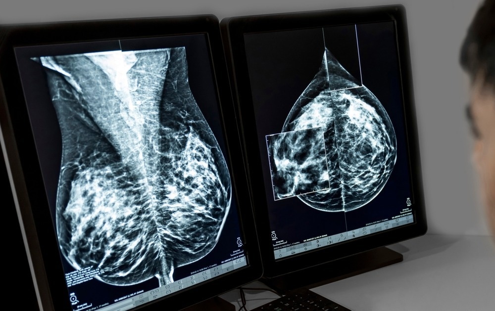 A doctor radiologist in a hospital mammography analysis room reading X-rays of a chest, breast and other parts of the body.