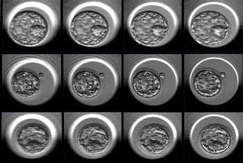 Researchers Develop Artificial Intelligence Approach to Improve Embryo Selection for In Vitro Fertilization