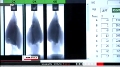 Mayekawa's High-Speed Pork Thigh Deboning Robot Uses X-rays