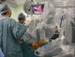 NHCS Surgeons Perform Robot-Assisted Lobectomies
