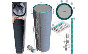 Novel Microfluidics-Enabled Soft Robotic Sleeve Enables Lymphedema Treatment