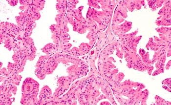 Researchers Create New AI-Based Techniques for Analyzing Digital Pathology Data