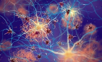 AI Model Predicts Cognitive Diseases Using Brain Age