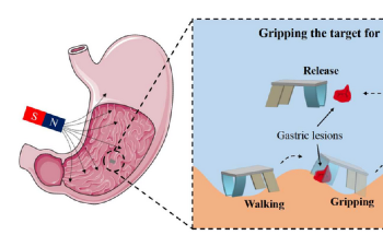 Gastric Biopsy Using Quadruped Soft Microrobot Powered by Magnetic Fields