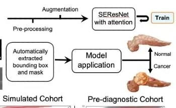 AI Algorithm Aids in the Early Detection of Pancreatic Cancer