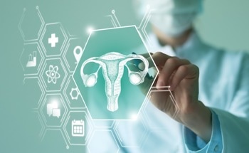 Precise AI Model Predicts Treatment Results of Ovarian Cancer