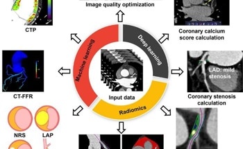 Artificial Intelligence in Coronary CT Angiography